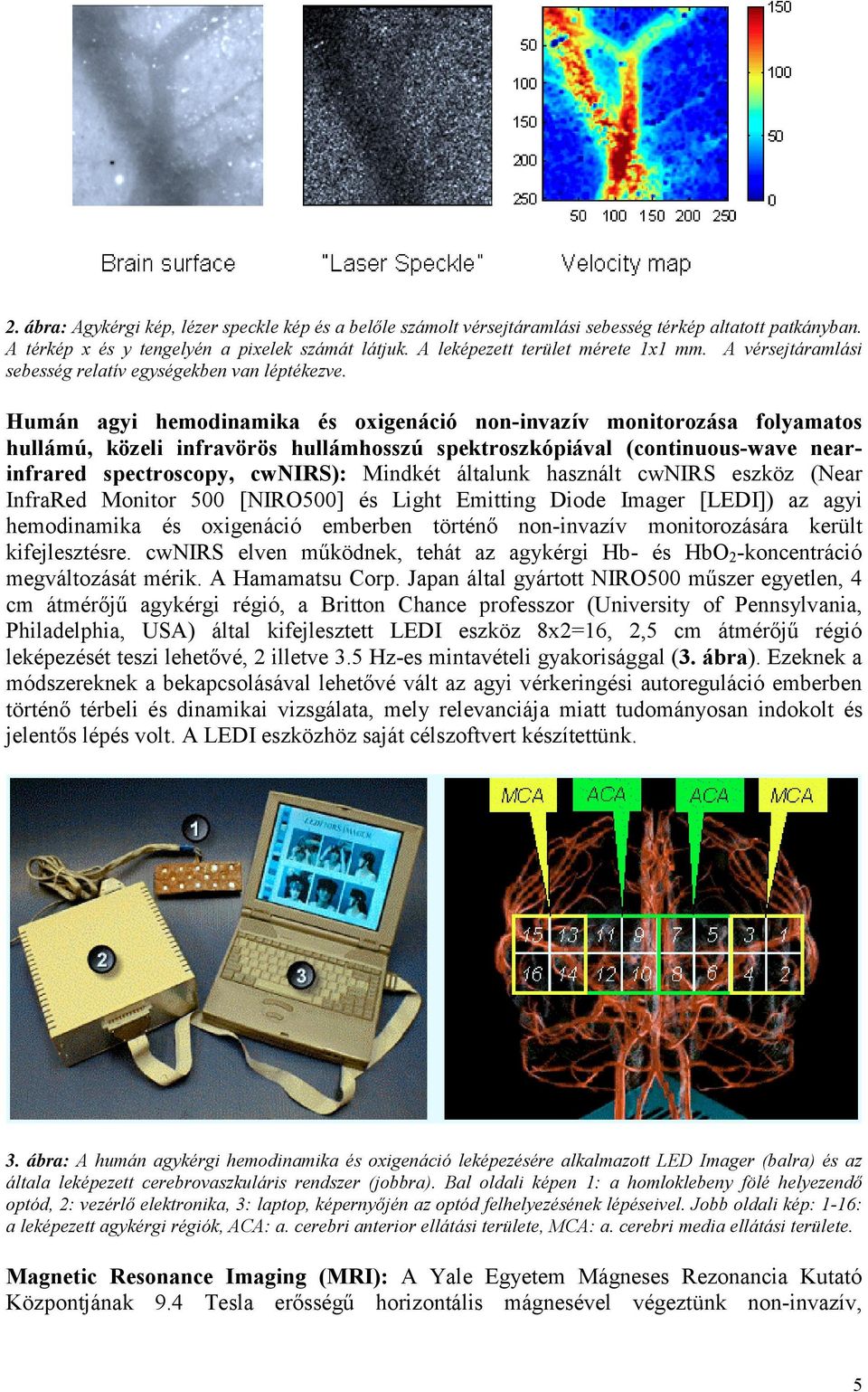 Humán agyi hemodinamika és oxigenáció non-invazív monitorozása folyamatos hullámú, közeli infravörös hullámhosszú spektroszkópiával (continuous-wave nearinfrared spectroscopy, cwnirs): Mindkét