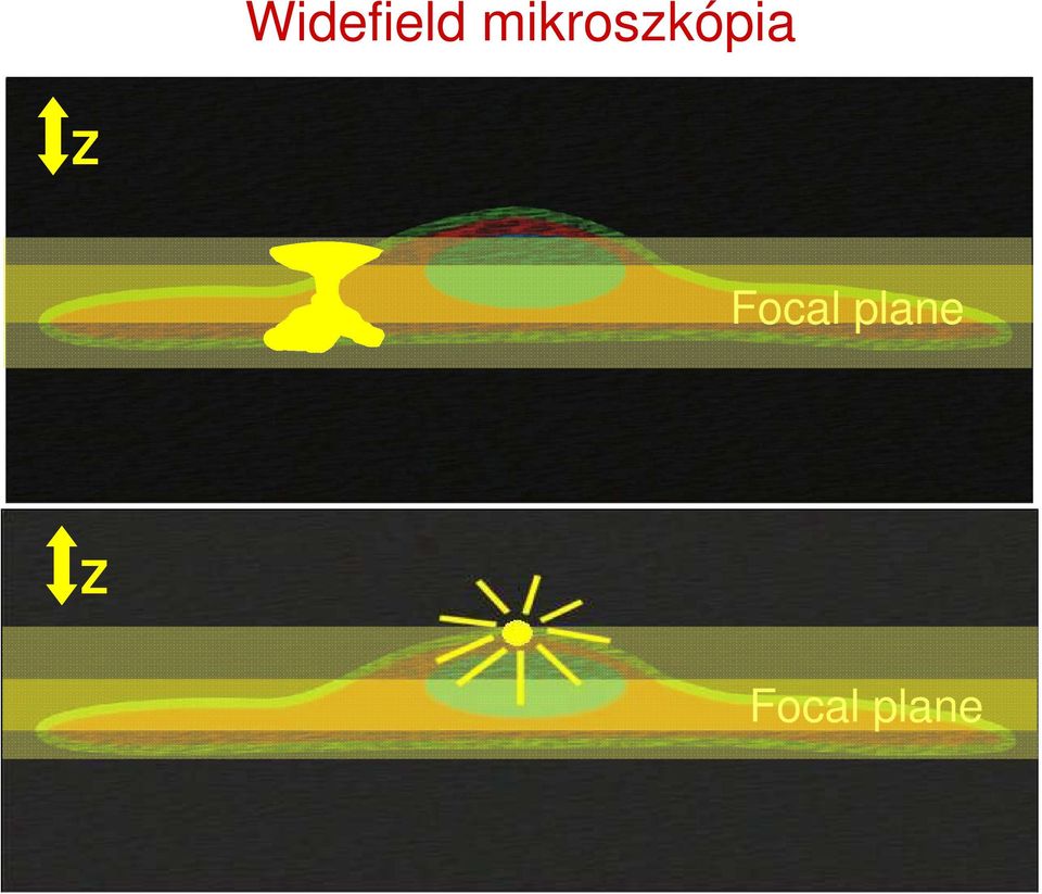 Z Focal