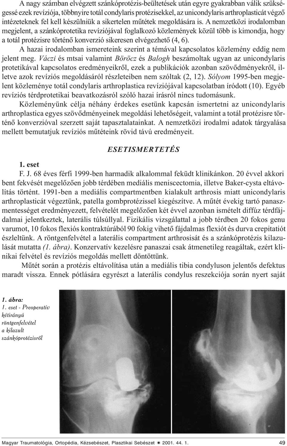 A nemzetközi irodalomban megjelent, a szánkóprotetika revíziójával foglalkozó közlemények közül több is kimondja, hogy a totál protézisre történõ konverzió sikeresen elvégezhetõ (4, 6).