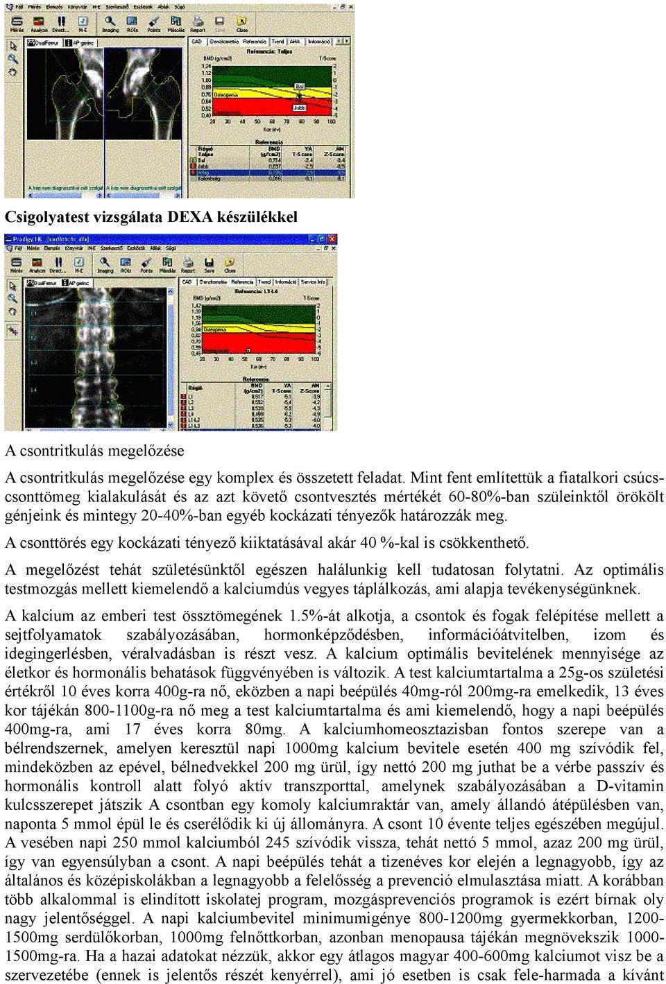 meg. A csonttörés egy kockázati tényező kiiktatásával akár 40 %-kal is csökkenthető. A megelőzést tehát születésünktől egészen halálunkig kell tudatosan folytatni.