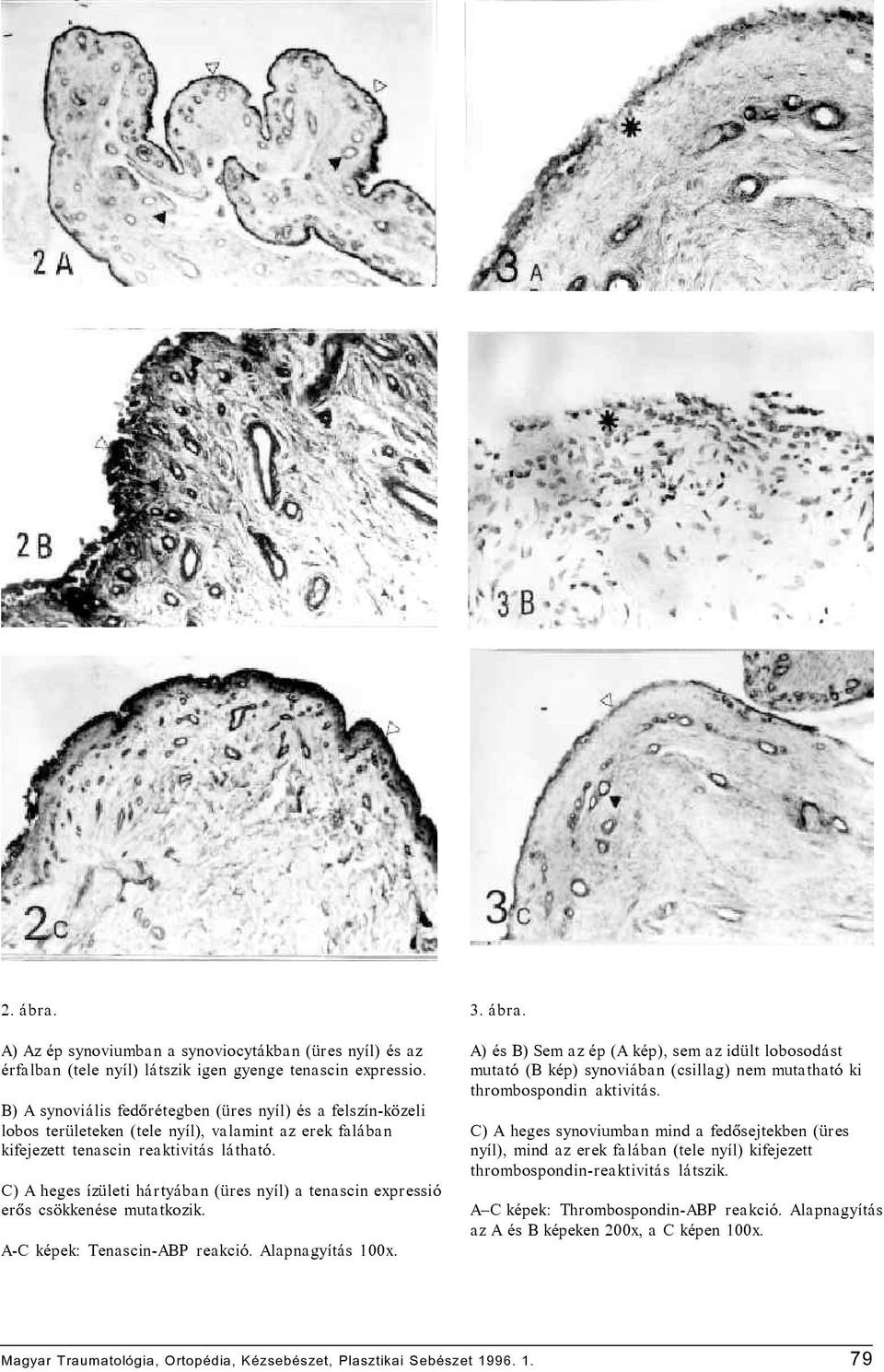 C) A heges ízületi hártyában (üres nyíl) a tenascin expressió erôs csökkenése mutatkozik. A-C képek: Tenascin-ABP reakció. Alapnagyítás 100x. 3. ábra.