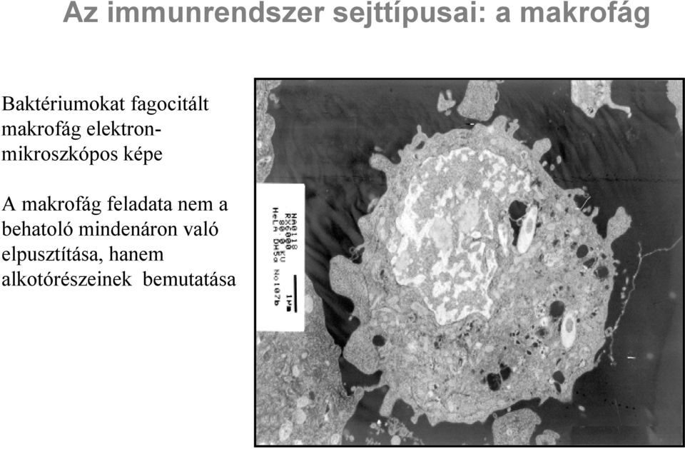 elektronmikroszkópos képe A makrofág feladata nem