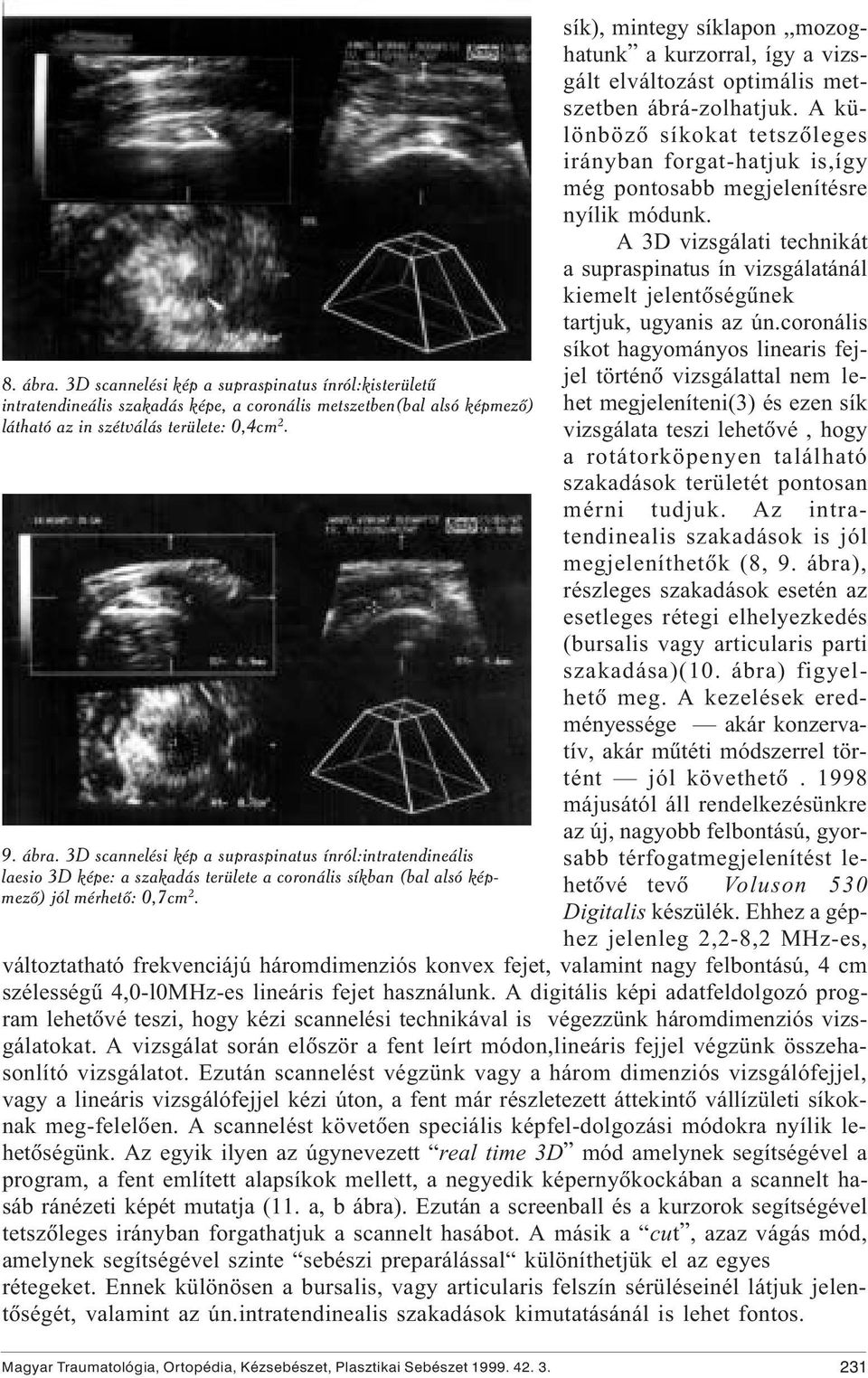 A különbözõ síkokat tetszõleges irányban forgat-hatjuk is,így még pontosabb megjelenítésre nyílik módunk.