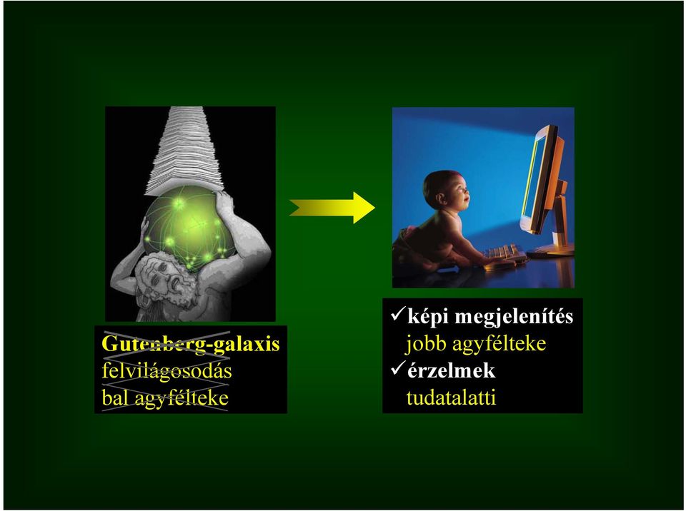 agyfélteke képi