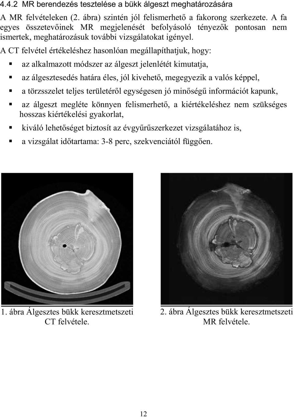 A CT felvétel értékeléshez hasonlóan megállapíthatjuk, hogy: az alkalmazott módszer az álgeszt jelenlétét kimutatja, az álgesztesedés határa éles, jól kivehet, megegyezik a valós képpel, a