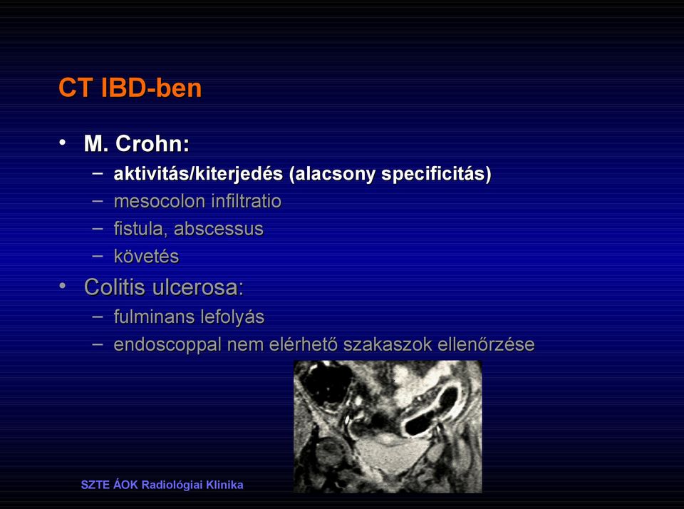 specificitás) mesocolon infiltratio fistula,