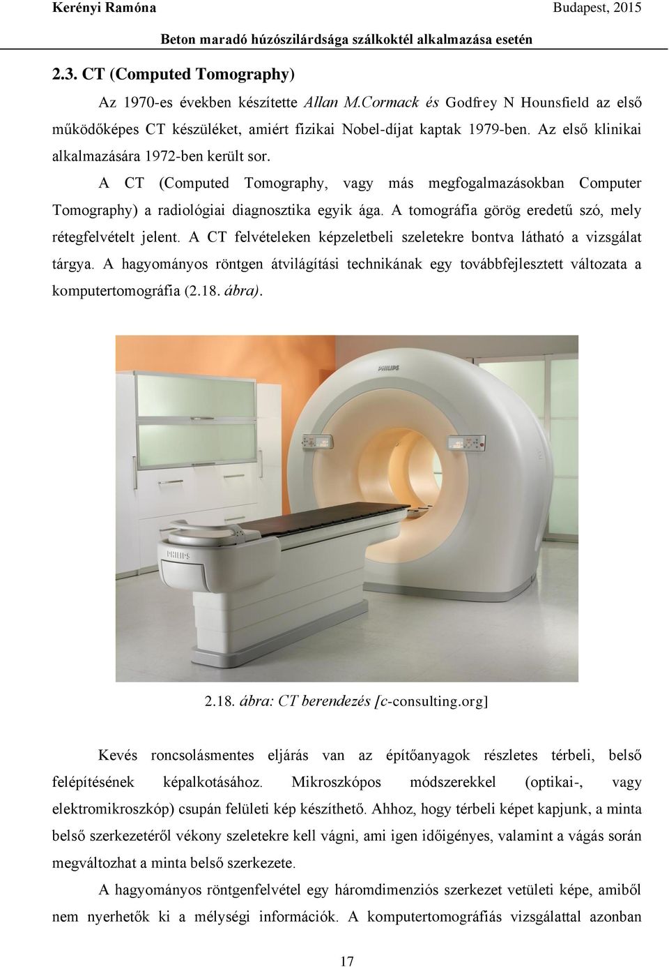 A tomográfia görög eredetű szó, mely rétegfelvételt jelent. A CT felvételeken képzeletbeli szeletekre bontva látható a vizsgálat tárgya.