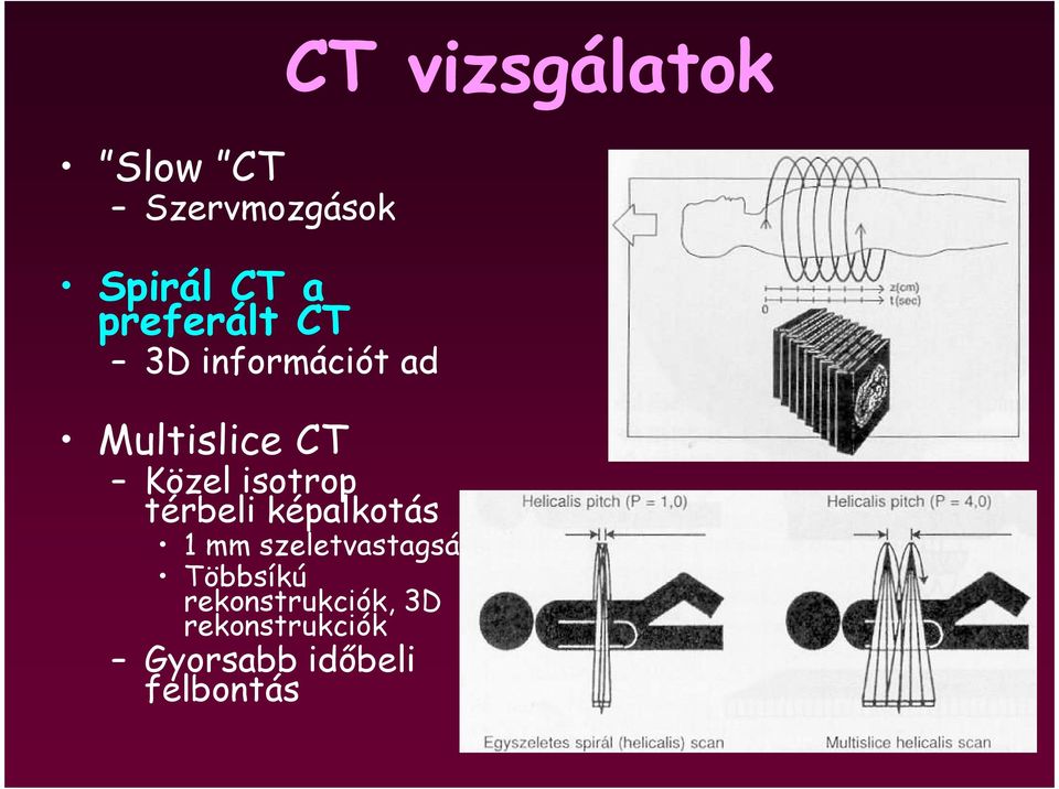 képalkotás 1 mm szeletvastagság Többsíkú