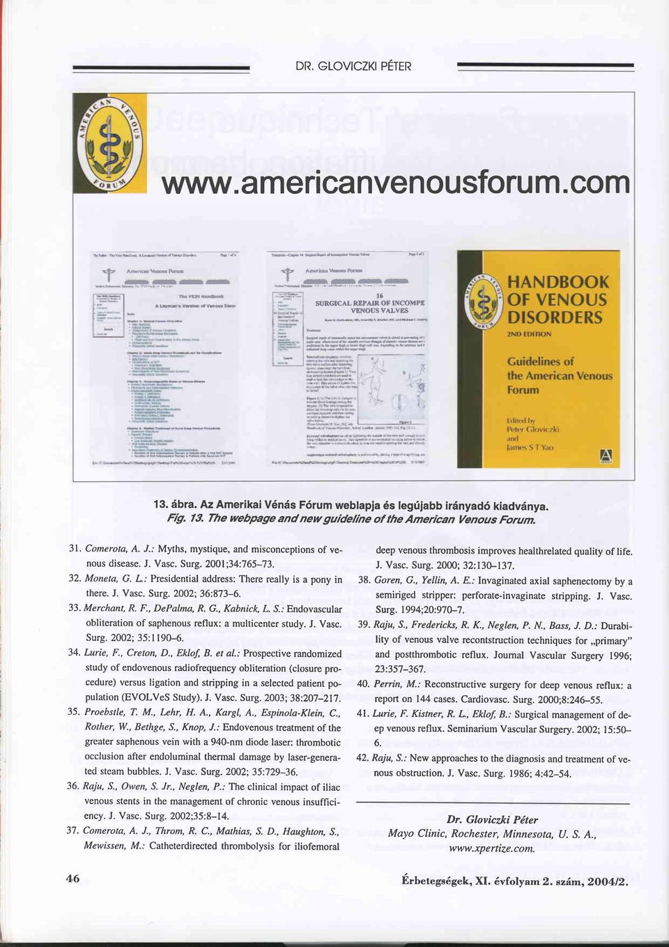 ; Myths, mystique, and misconceptions of venous disease. J. Vasc. Surg.200l;34:765-73. 32. Moneta, G. L: Presidential address: There really is a pony in there. J. Vasc. Surg. 2002;36:873-6. 33.
