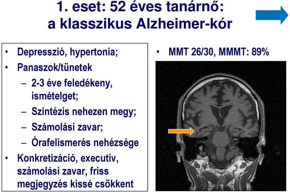 nehezen megy; Számolási zavar; Órafelismerés nehézsége Konkretizáció,