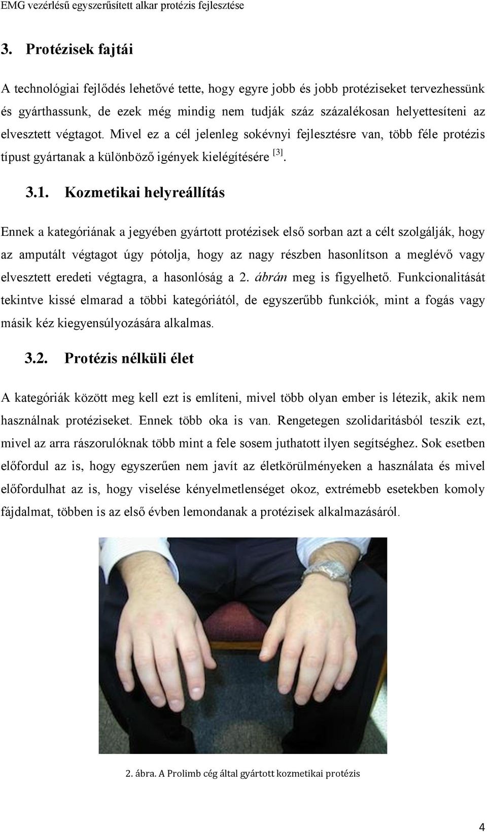 Kozmetikai helyreállítás Ennek a kategóriának a jegyében gyártott protézisek első sorban azt a célt szolgálják, hogy az amputált végtagot úgy pótolja, hogy az nagy részben hasonlítson a meglévő vagy