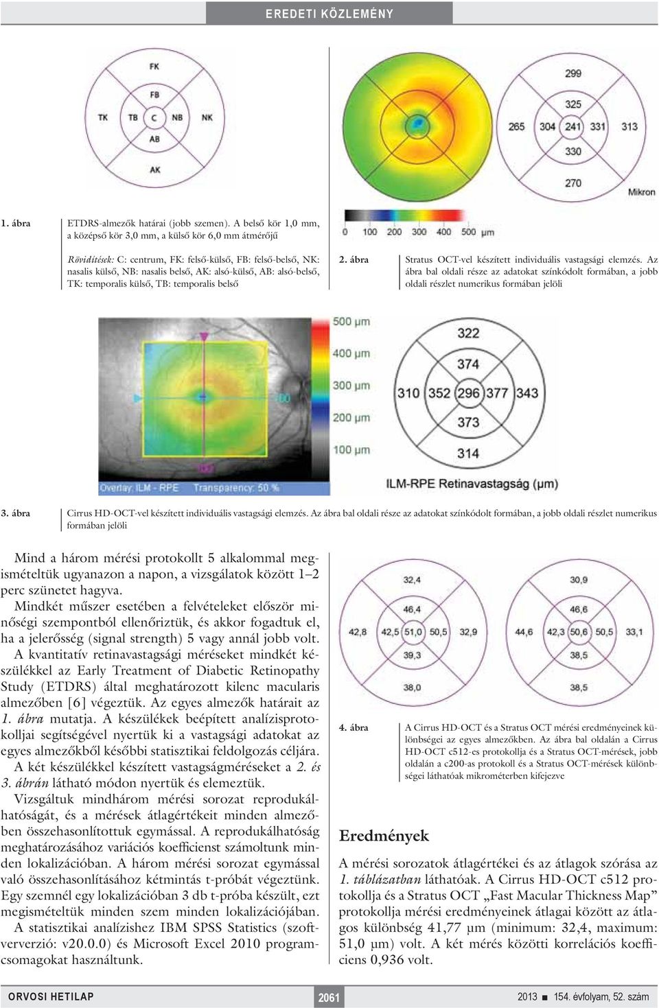 TK: temporalis külső, TB: temporalis belső 2. ábra Stratus OCT-vel készített individuális vastagsági elemzés.