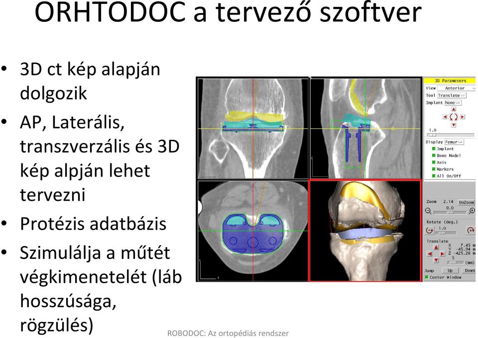 alpján lehet tervezni Protézis adatbázis