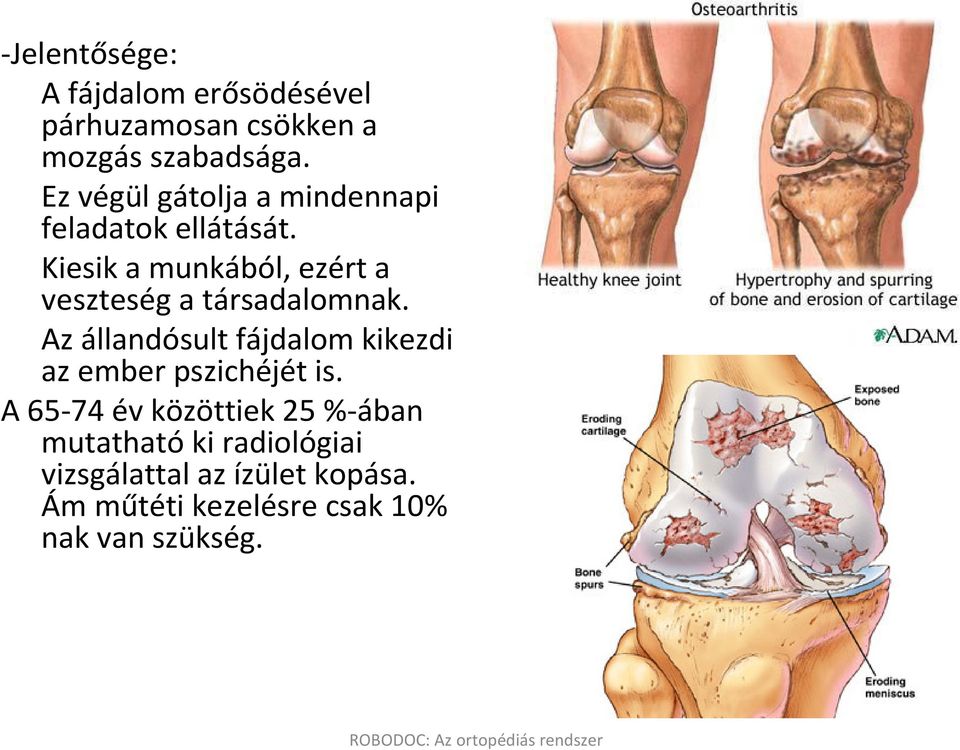 Kiesik a munkából, ezért a veszteség a társadalomnak.