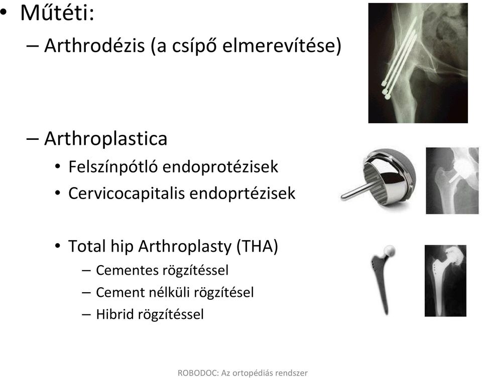 Cervicocapitalis endoprtézisek Total hip