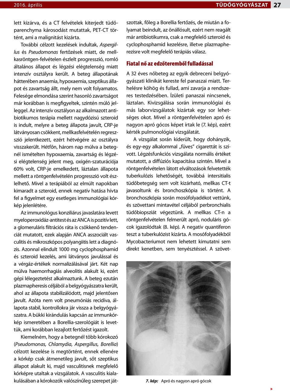 osztályra került. A beteg állapotának hátterében anaemia, hypoxaemia, szeptikus állapot és zavartság állt, mely nem volt folyamatos.