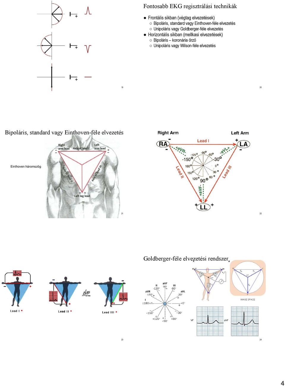 (mellkasi elvezetések) Bipoláris koronária őrző Unipoláris vagy Wilson-féle elvezetés 19 20