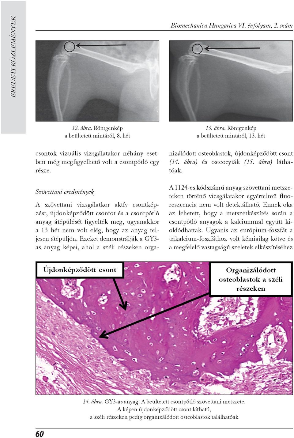 Szövettani eredmények A szövettani vizsgálatkor aktív csontkép - zést, újdonképződött csontot és a csontpótló anyag átépülését figyelték meg, ugyanakkor a 13 hét nem volt elég, hogy az anyag tel - je
