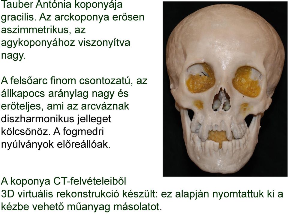 A felsőarc finom csontozatú, az állkapocs aránylag nagy és erőteljes, ami az arcváznak
