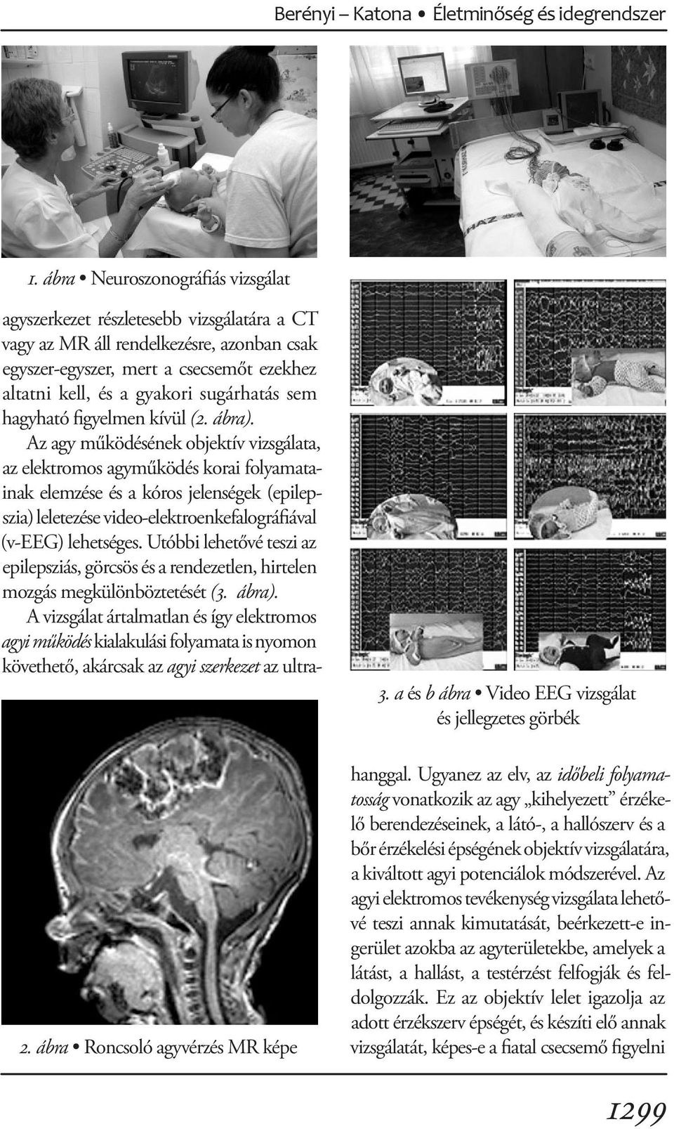 a gyakori sugárhatás sem hagyható figyelmen kívül (2. ábra).