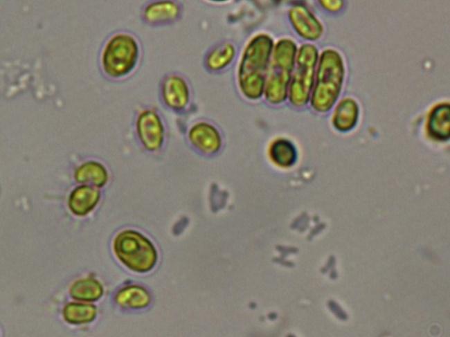Édesvízi algák az ökotoxikológiában Chlorella vulgaris mikroszkópos képe (BME-ABÉT)