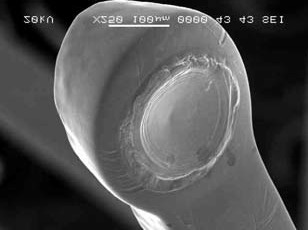 hegesztési sebesség, modulált trailing edge impulzusalak []; b) Lézersugárral hegesztett Ta-, Zr-, Au-, Pt-marker rögzítési módjának