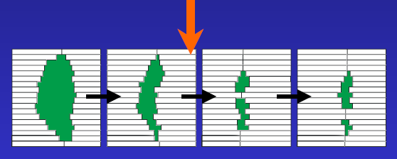 Intenzitás modulált sugárterápia (IMRT) - Step-and-shoot IMRT - Dinamikus IMRT - Sliding window -