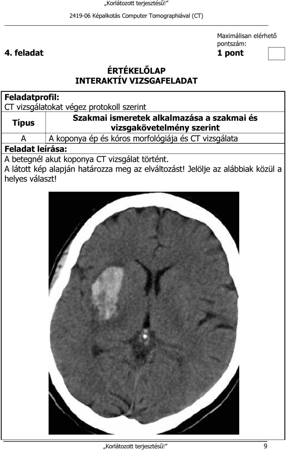 ismeretek alkalmazása a szakmai és Típus vizsgakövetelmény szerint A A koponya ép és kóros morfológiája és CT vizsgálata