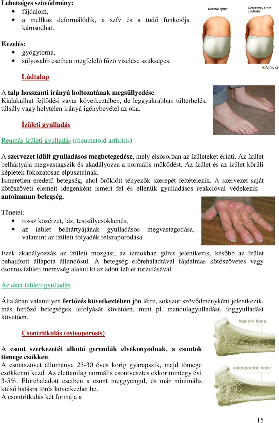 Ízületi gyulladás Reumás ízületi gyulladás (rheumatoid arthritis) A szervezet idült gyulladásos megbetegedése, mely elsősorban az ízületeket érinti.