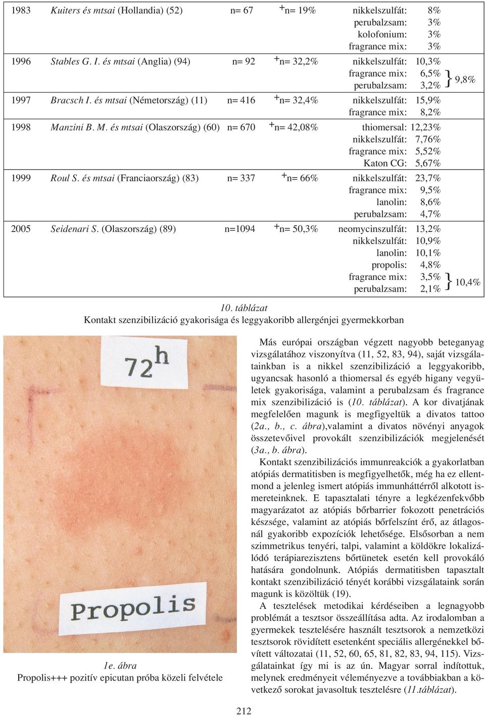 és mtsai (Németország) (11) n= 416 + n= 32,4% nikkelszulfát: 15,9% fragrance mix: 8,2% 1998 Ma