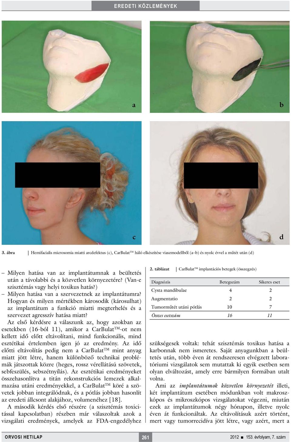 és a közvetlen környezetére? (Van-e szisztémás vagy helyi toxikus hatás?) Milyen hatása van a szervezetnek az implantátumra?