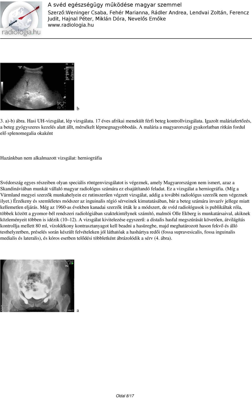 A malária a magyarországi gyakorlatban ritkán fordul elő splenomegalia okaként Hazánkban nem alkalmazott vizsgálat: herniográfia Svédország egyes részeiben olyan speciális röntgenvizsgálatot is