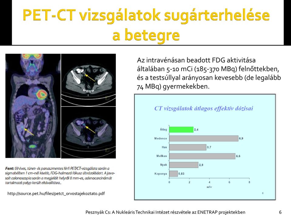 gyermekekben. http://source.pet.hu/files/petct_orvostajekoztato.