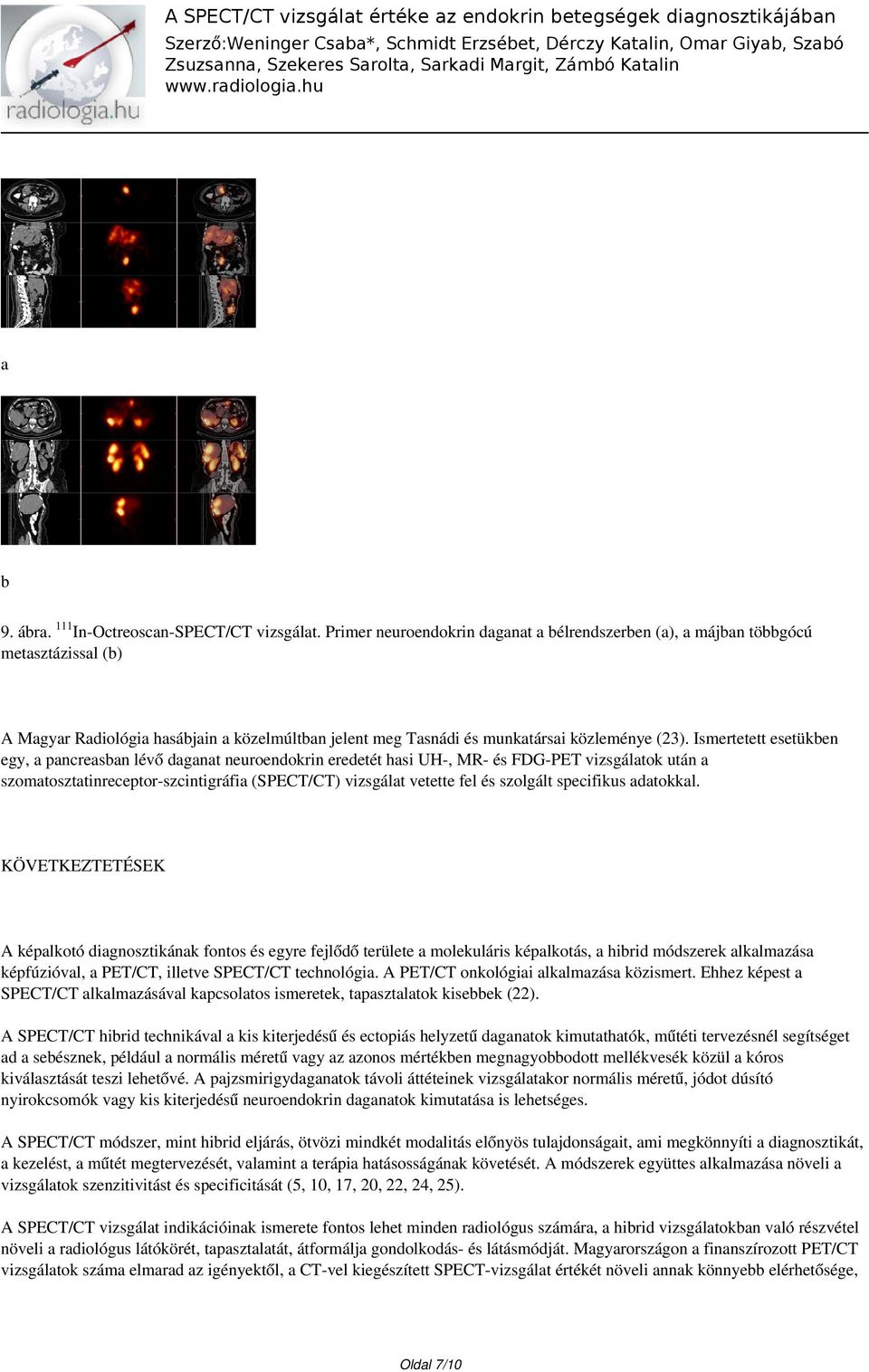 Ismertetett esetükben egy, a pancreasban lévő daganat neuroendokrin eredetét hasi UH-, MR- és FDG-PET vizsgálatok után a szomatosztatinreceptor-szcintigráfia (SPECT/CT) vizsgálat vetette fel és