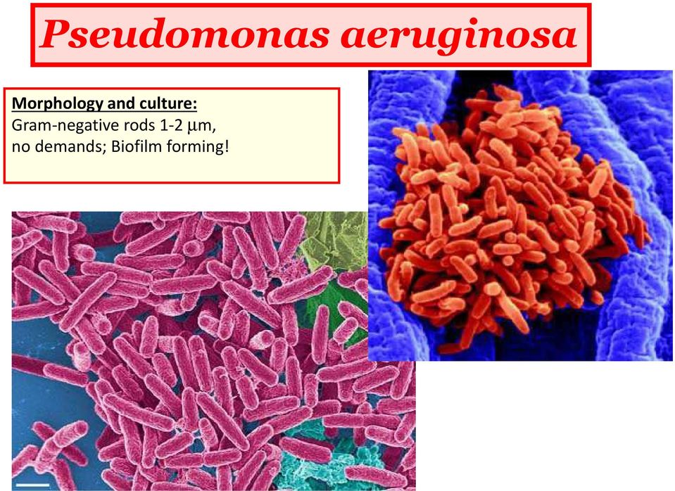 Gram-negative rods 1-2