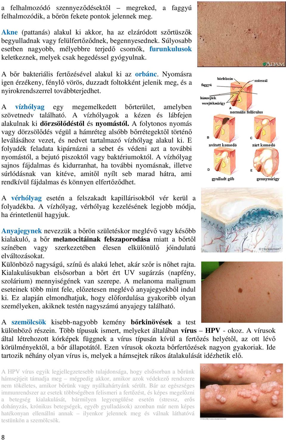 Súlyosabb esetben nagyobb, mélyebbre terjedő csomók, furunkulusok keletkeznek, melyek csak hegedéssel gyógyulnak. A bőr bakteriális fertőzésével alakul ki az orbánc.