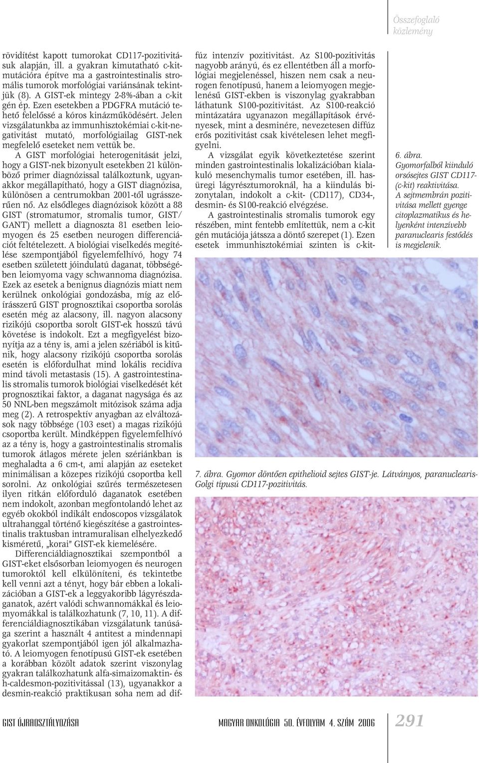 Jelen vizsgálatunkba az immunhisztokémiai c-kit-negativitást mutató, morfológiailag GIST-nek megfelelô eseteket nem vettük be.