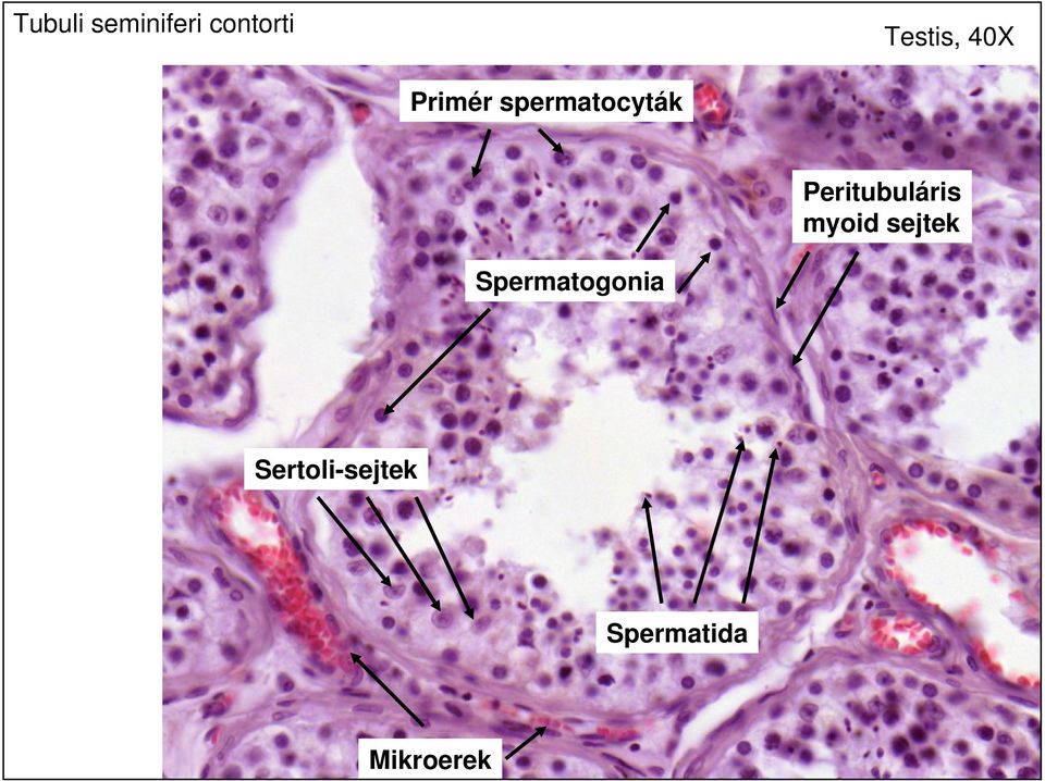 Peritubuláris myoid sejtek