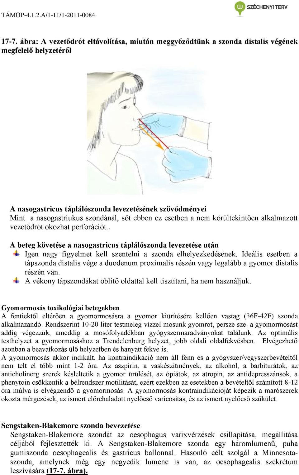 . A beteg követése a nasogastricus táplálószonda levezetése után Igen nagy figyelmet kell szentelni a szonda elhelyezkedésének.