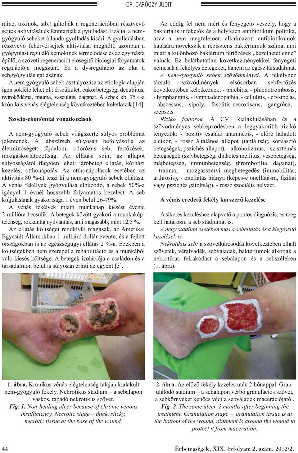 megszűnt. Ez a dysreguláció az oka a sebgyógyulás gátlásának. A nem gyógyuló sebek osztályozása az etiologia alapján igen sokféle lehet pl.