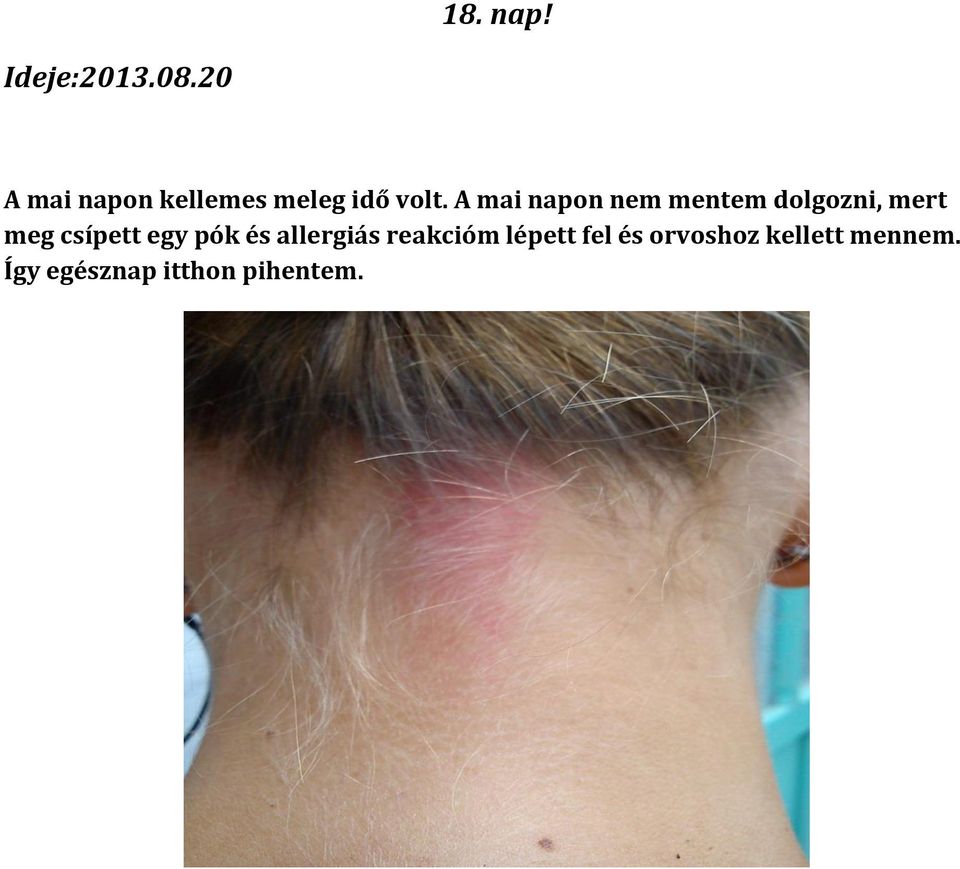 A mai napon nem mentem dolgozni, mert meg csípett