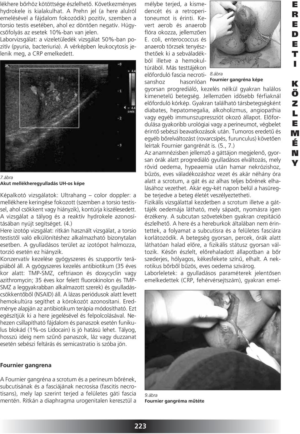 aborvizsgálat: a vizeletüledék vizsgálat 50%-ban pozi tív (pyuria, bacteriuria). A vérképben leukocytosis jelenik meg, a CP emelkedett. 7.