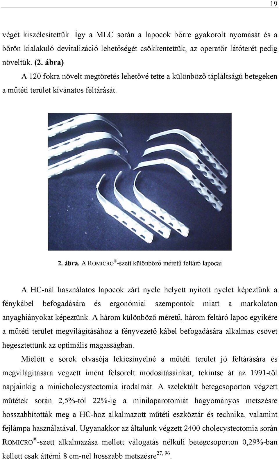 A ROMICRO -szett különböző méretű feltáró lapocai A HC-nál használatos lapocok zárt nyele helyett nyitott nyelet képeztünk a fénykábel befogadására és ergonómiai szempontok miatt a markolaton