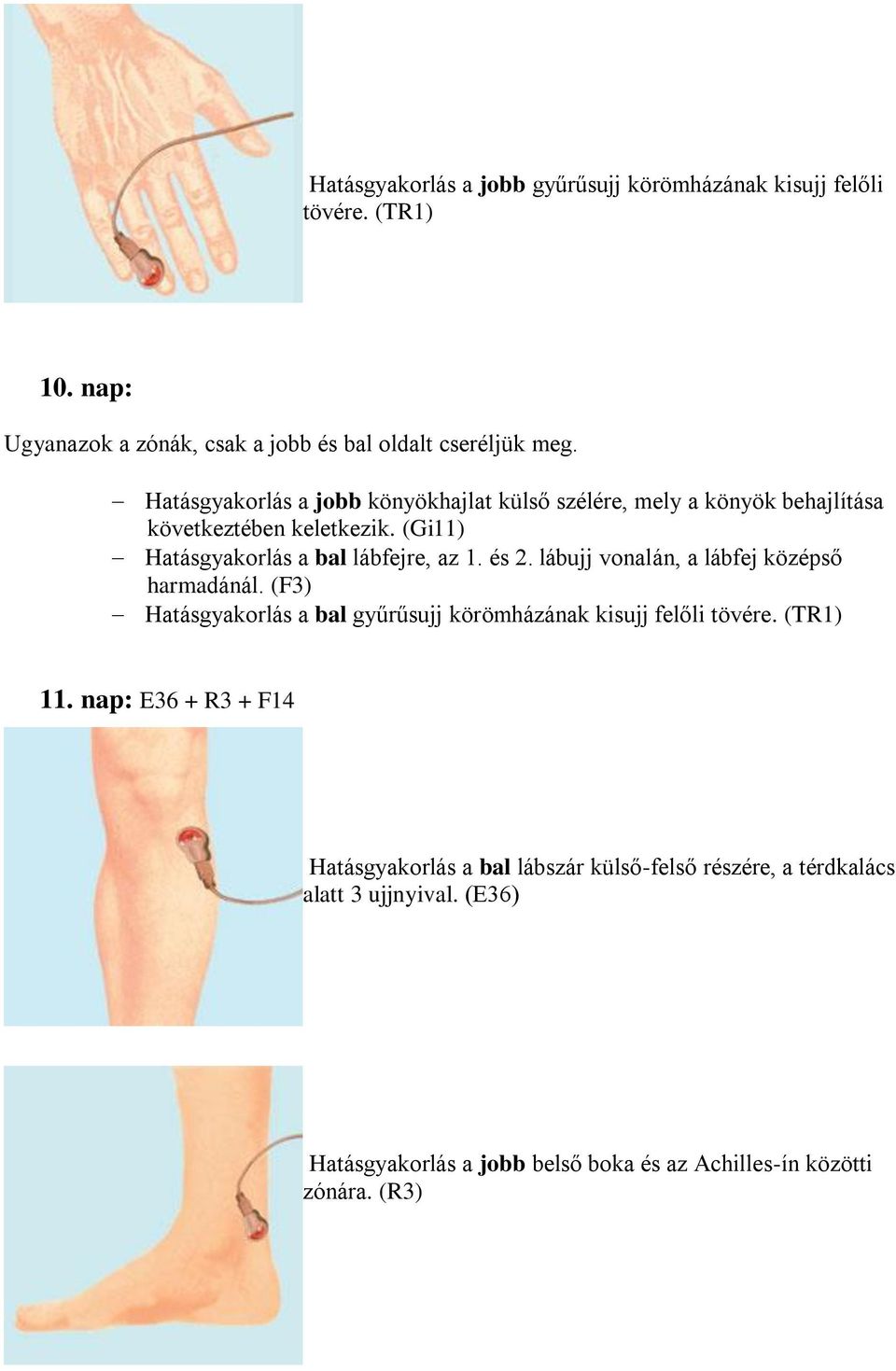 (Gi11) Hatásgyakorlás a bal lábfejre, az 1. és 2. lábujj vonalán, a lábfej középső harmadánál.