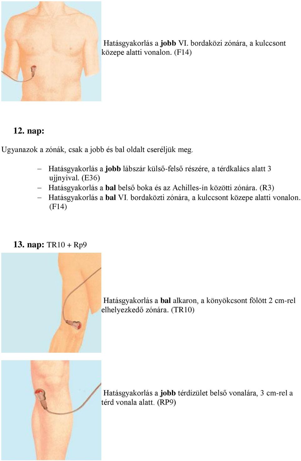 (Е36) Hatásgyakorlás a bal belső boka és az Achilles-ín közötti zónára. (R3) Hatásgyakorlás a bal VI.