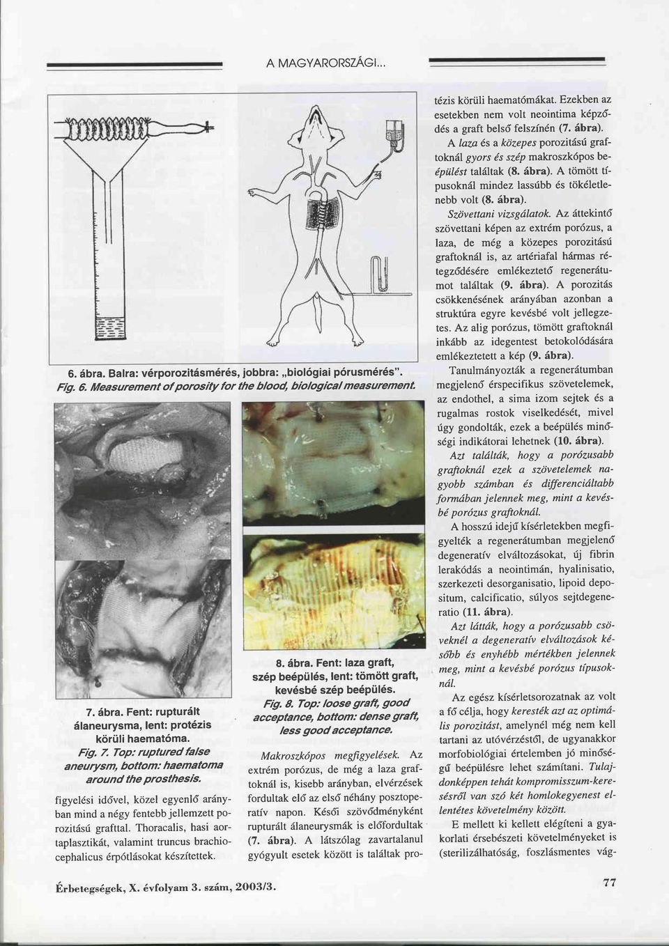 Thoracalis, hasi aortaplasztikät, valamintruncus brachiocephalicus 6rp6tläsokat k6szitettek. 8. äbra. Fent: laza graft, sz6p be6pü16s, lent: tömött graft, kev6sb6 sz6p be6pü16s. Ftg. S.