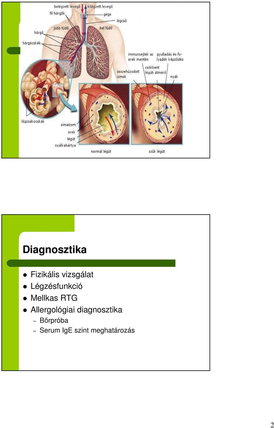 RTG Allergológiai diagnosztika