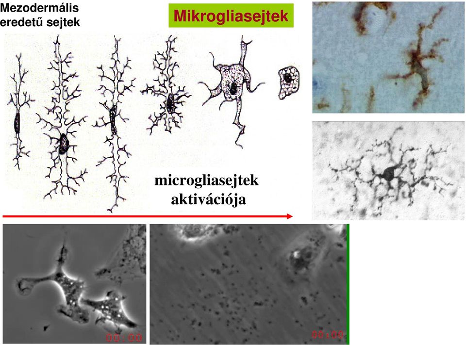 Mikrogliasejtek