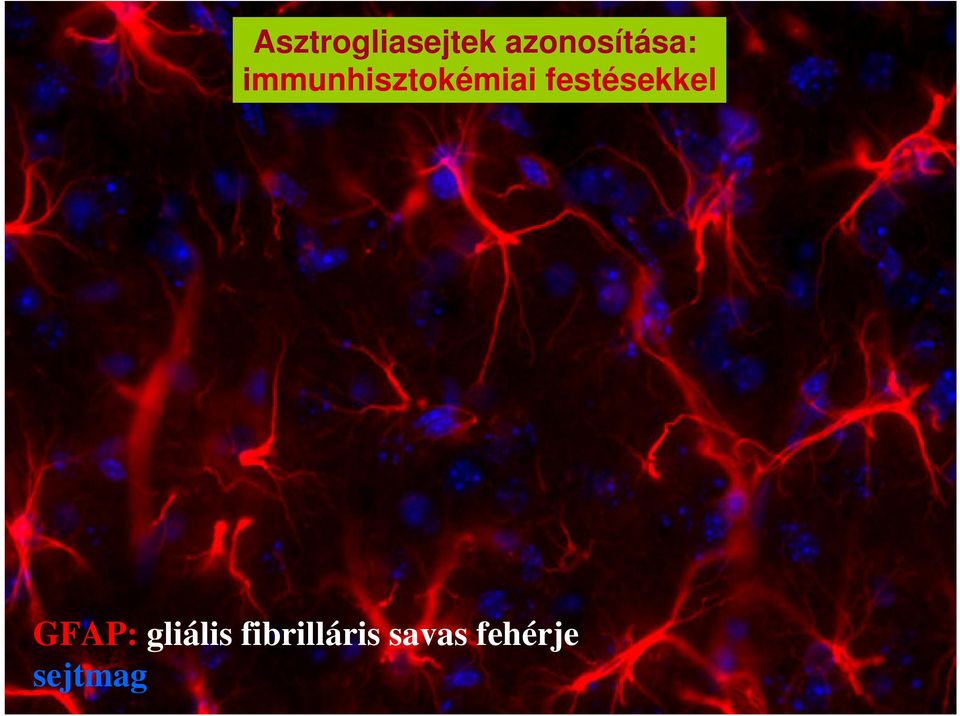immunhisztokémiai