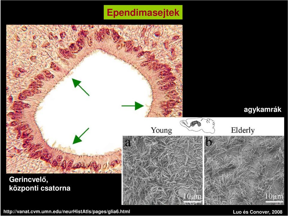 fluid-filled lumen of the central canal. Ependymal cells are a special type of neuroglia.